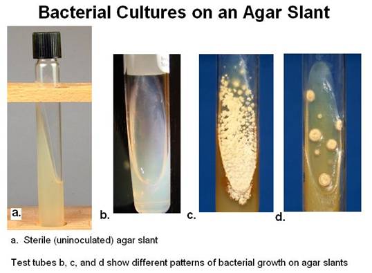 agar slant bacterial growth.JPG